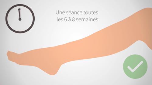 Animation Clinique Laser